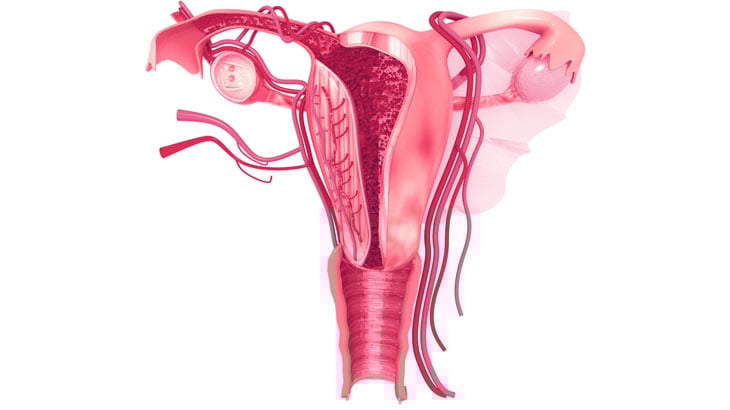 چسبندگی رحم