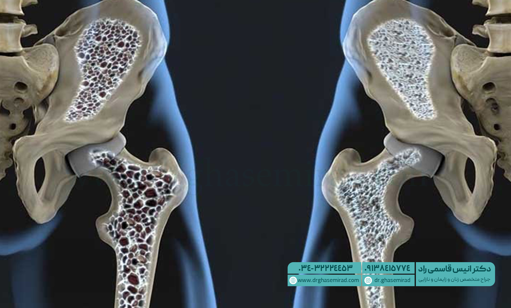 علائم یائسگی در زنان